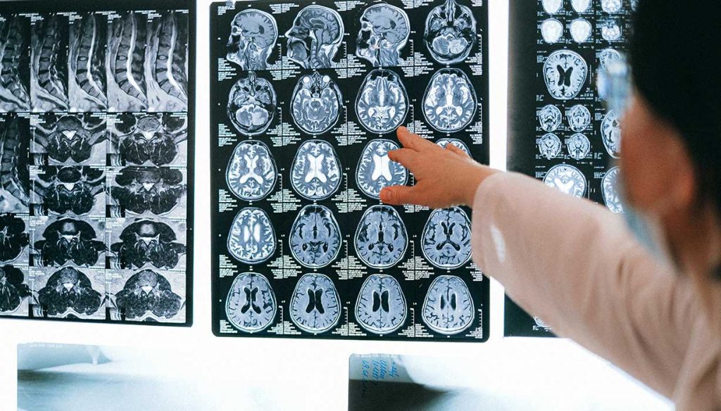 doctor viewing patient's mri results